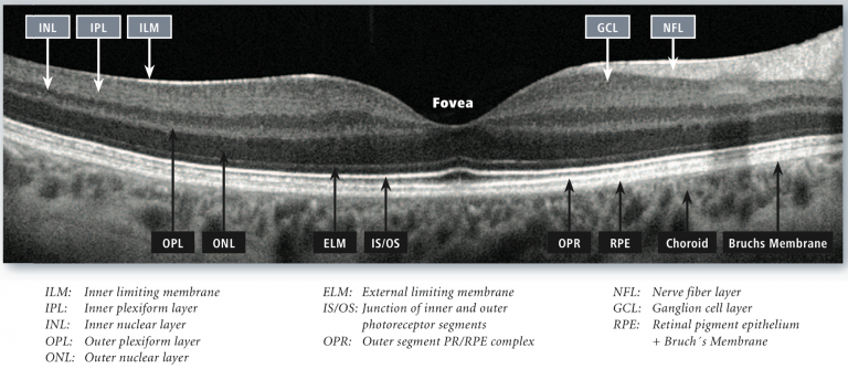 Outer Retinal Layers Oct