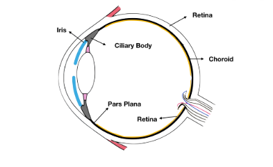 Anatomical Classification of Uveitis