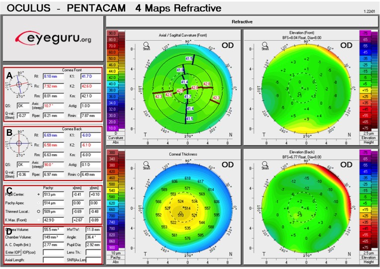 how-to-read-corneal-topography-maps-design-talk