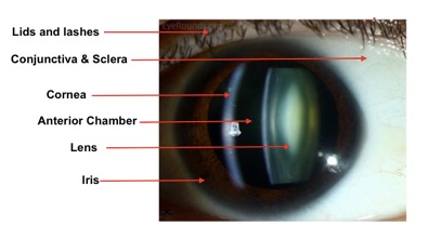 slit lamp eye